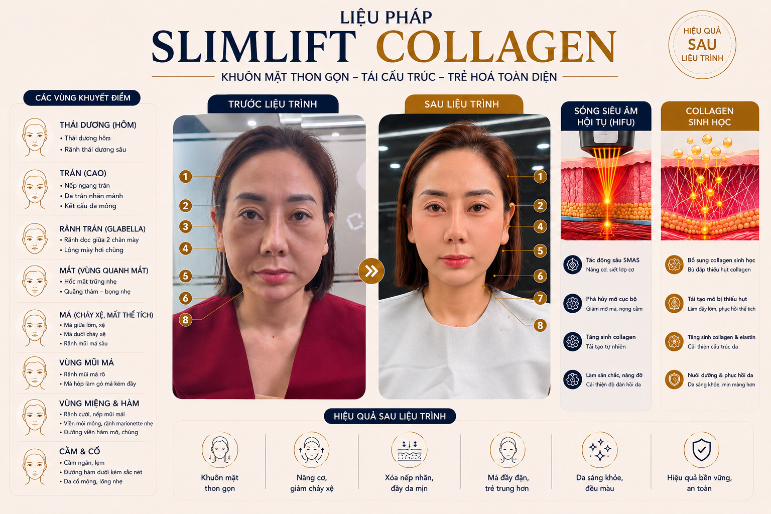 SlimLift Collagen