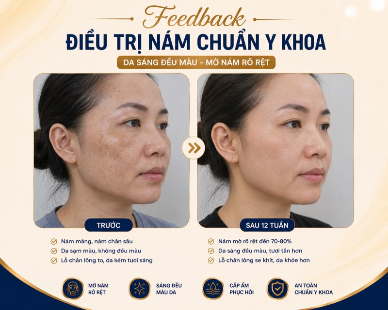 Feedback điều trị nám