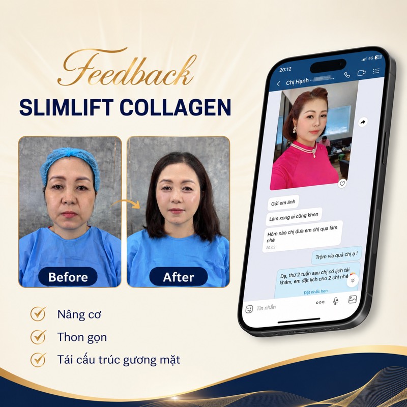 Feedback SlimLift Collagen nâng cơ thon gọn