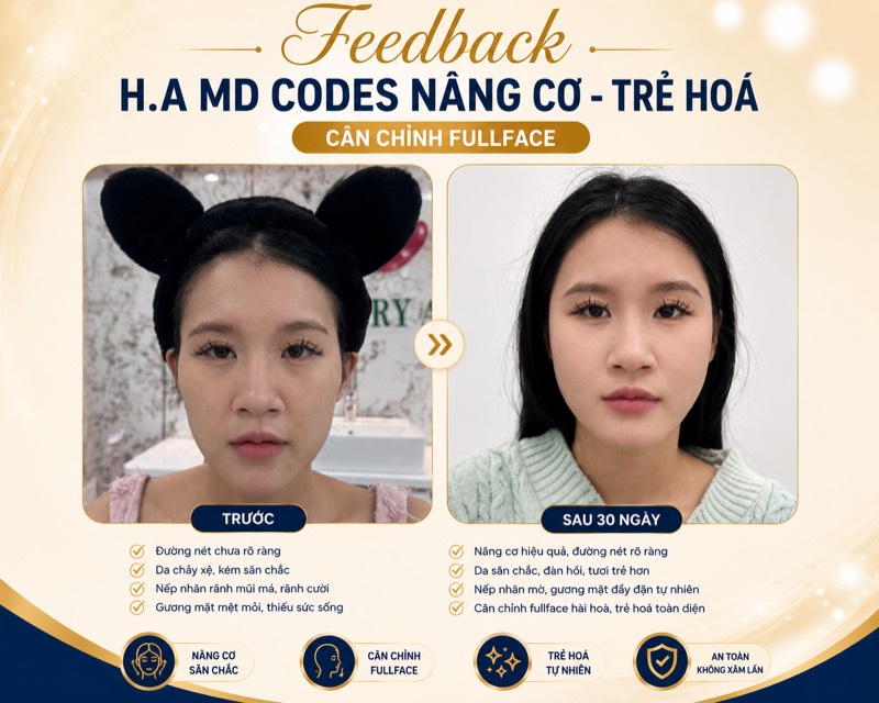 Feedback H.A MD CODES cân chỉnh fullface