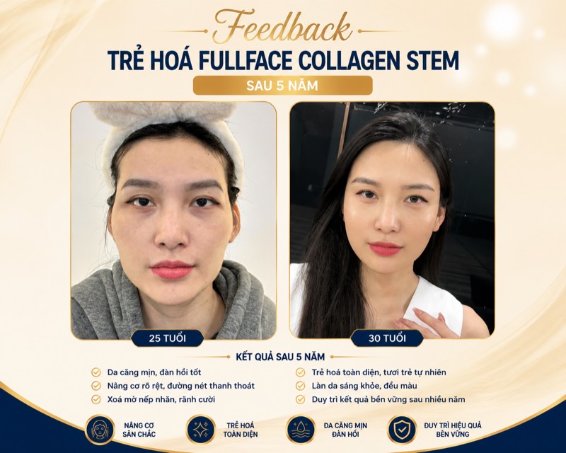Feedback trẻ hoá Collagen STEM sau 5 năm