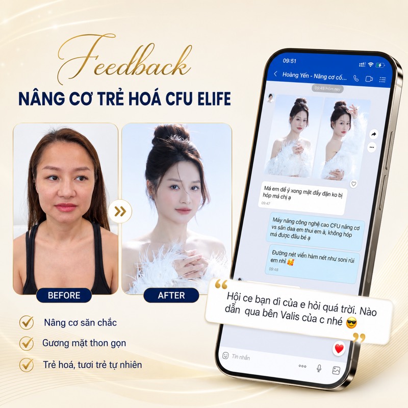 Feedback nâng cơ CFU Elife thon gọn