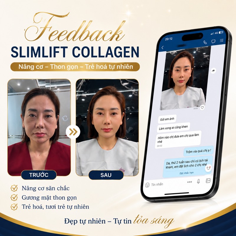 Feedback SlimLift Collagen trẻ hoá